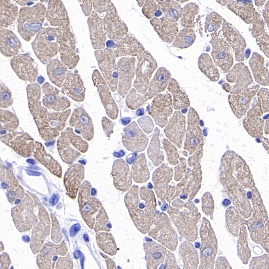 MYBPC3 Recombinant Rabbit mAb (S-5476)