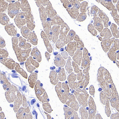 MYBPC3 Recombinant Rabbit mAb (S-5476)