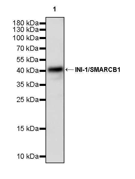 INI-1/SMARCB1 Recombinant Rabbit mAb (S-4068-21)