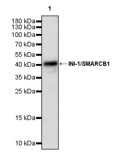 INI-1/SMARCB1 Recombinant Rabbit mAb (S-4068-21)