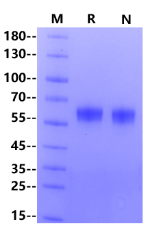 DDR1 His Tag Protein, Human
