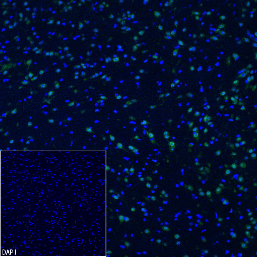 NOVA1 Recombinant Rabbit mAb (S-4031-71)