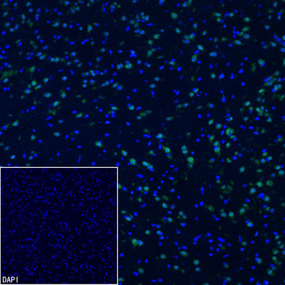 NOVA1 Recombinant Rabbit mAb (S-4031-71)