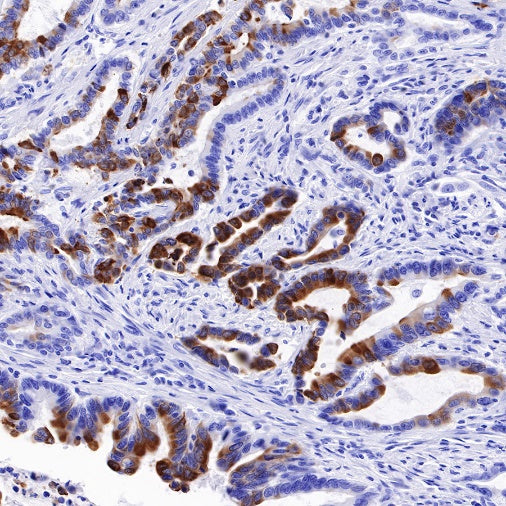TFF1 Recombinant Rabbit mAb (S-481-16)