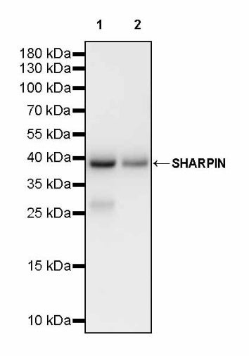 SHARPIN Recombinant Rabbit mAb (S-2356-308)