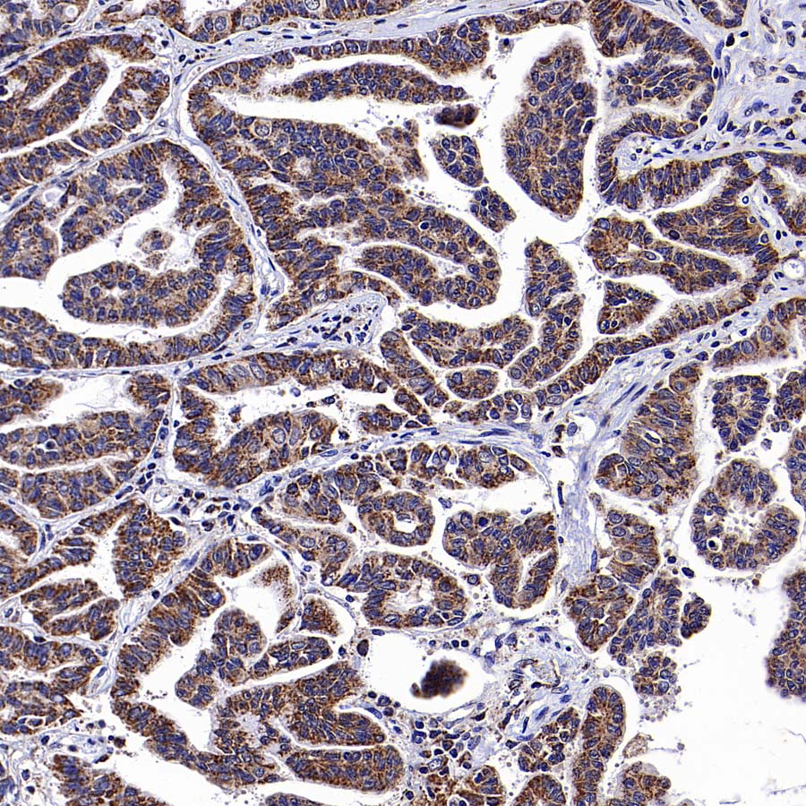 USP14 Recombinant Rabbit mAb (S-4022-13)