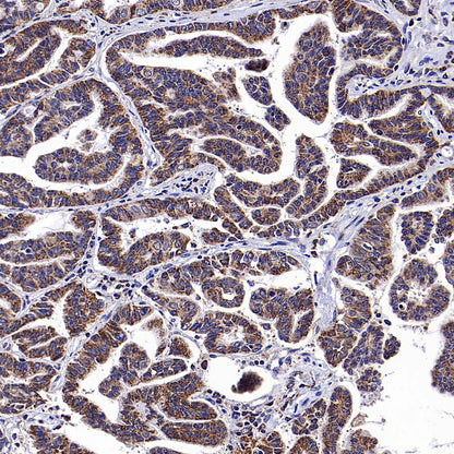 USP14 Recombinant Rabbit mAb (S-4022-13)