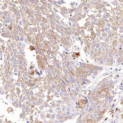 M6PR Recombinant Rabbit mAb (S-2348-14)