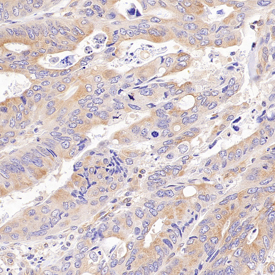 CDS2 Recombinant Rabbit mAb (S-3670-56)