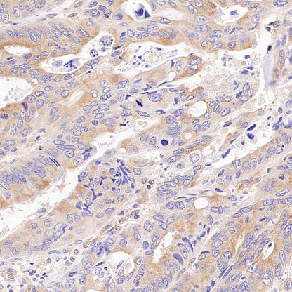 CDS2 Recombinant Rabbit mAb (S-3670-56)