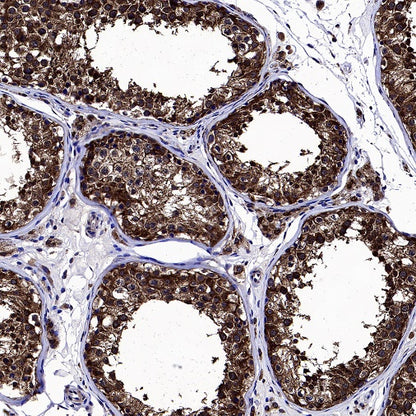 mTOR Recombinant Rabbit mAb (S-698-228)