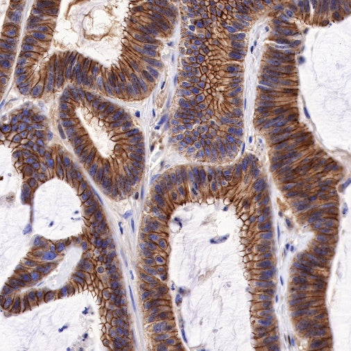 S-RMab® E-Cadherin Recombinant Rabbit mAb (SDT-438-5)