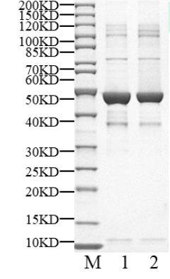 PIP4K2B Protein, Human