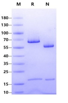 PCSK9 His Tag(D374Y) Protein, Human