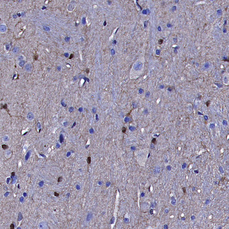 GSTM1 Rabbit Polyclonal Antibody