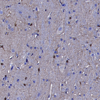 GSTM1 Rabbit Polyclonal Antibody