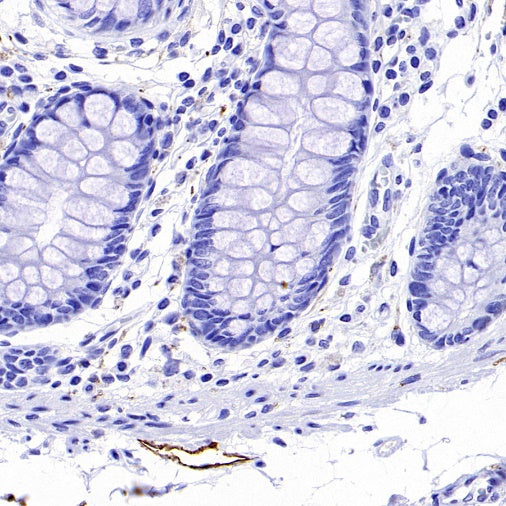 Podoplanin (D2-40) Recombinant Rabbit mAb (SDT-1178-8)