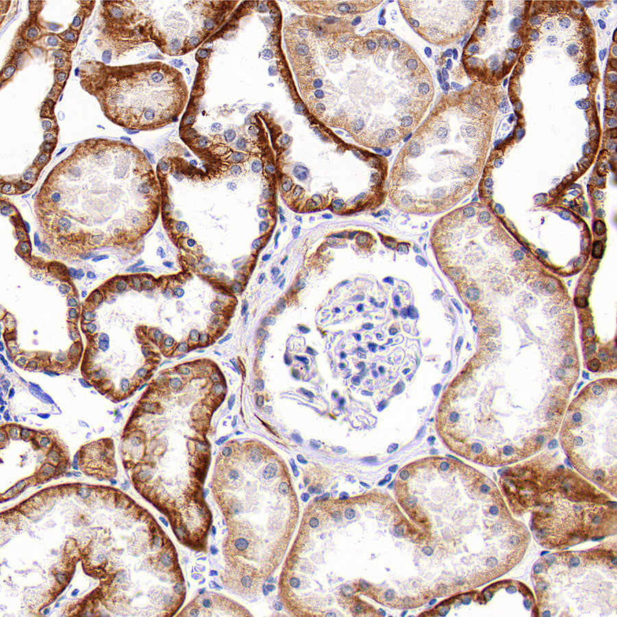 SLC43A2 Recombinant Rabbit mAb (S-4492-33)