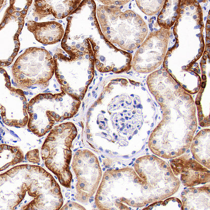 SLC43A2 Recombinant Rabbit mAb (S-4492-33)