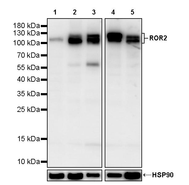 ROR2 Recombinant Rabbit mAb (S-3787-105)