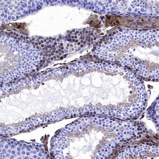 PKC delta Recombinant Rabbit mAb (S-2611-39)