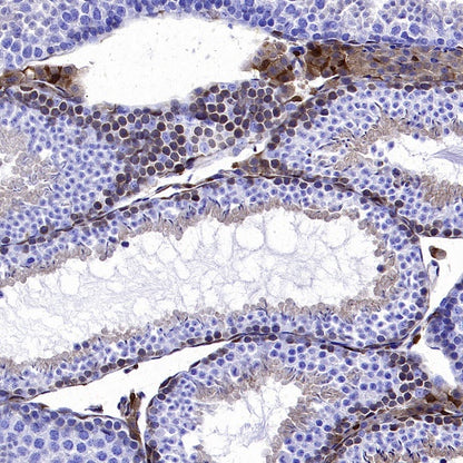 PKC delta Recombinant Rabbit mAb (S-2611-39)