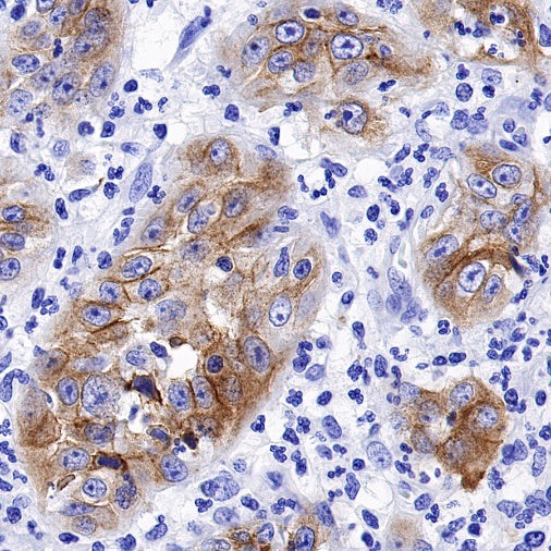 Collagen XVII Recombinant Rabbit mAb (S-1636-5)
