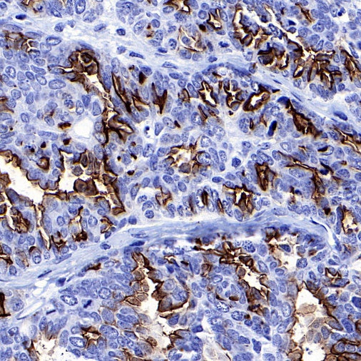 MUC1/EMA Mouse mAb (SDT-777-37)
