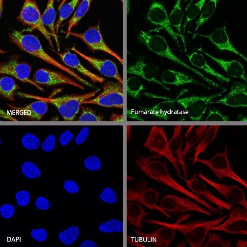 Fumarate hydratase Recombinant Rabbit mAb (SDT-2434-54)