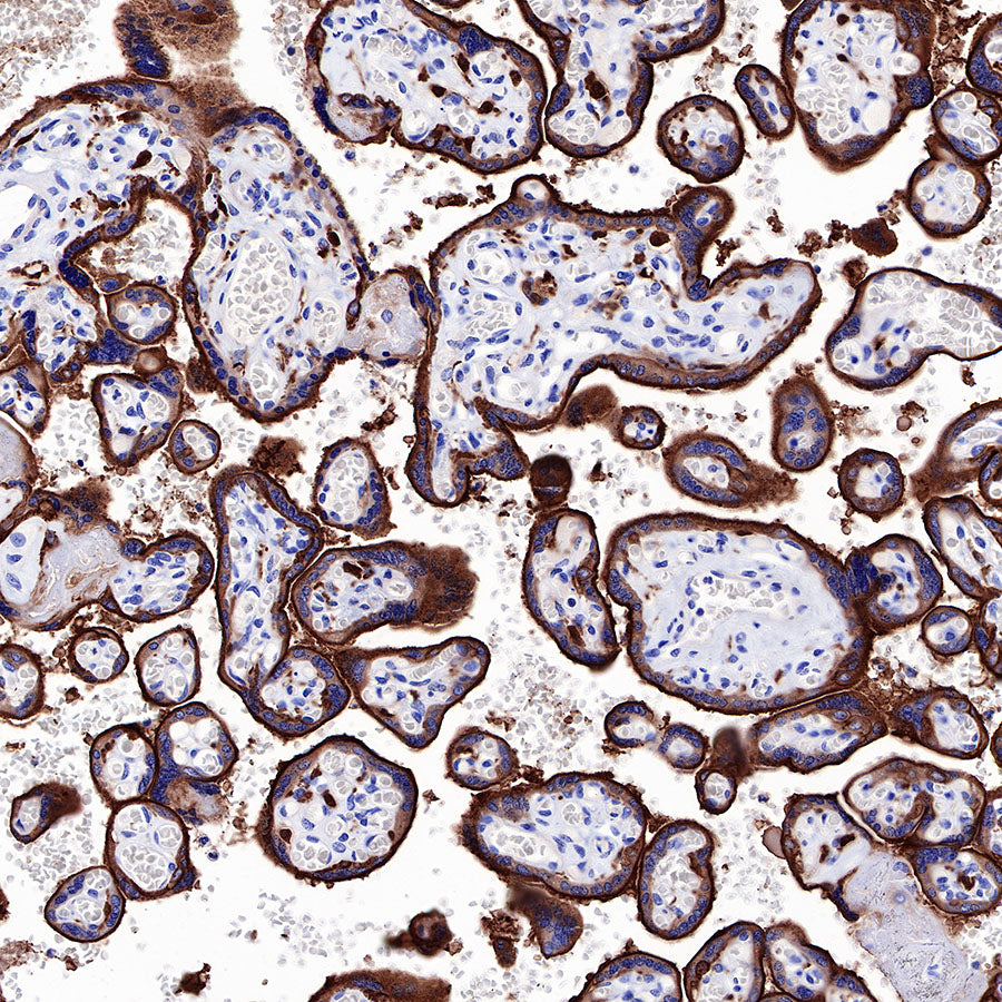 EGFR Recombinant Rabbit mAb (SDT-R110)