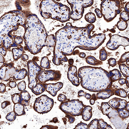 EGFR Recombinant Rabbit mAb (SDT-R110)