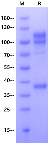 LAT1-4F2hc Flag & His tag Protein, Human (Detergent)
