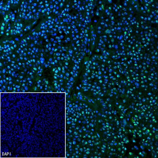 Wilms Tumor Protein (WT1) Recombinant Rabbit mAb (SDT-2864)