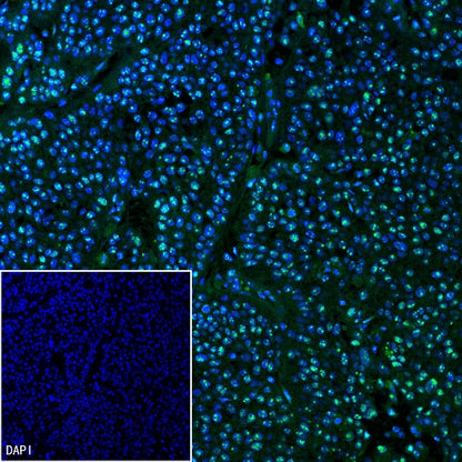 Wilms Tumor Protein (WT1) Recombinant Rabbit mAb (SDT-2864)
