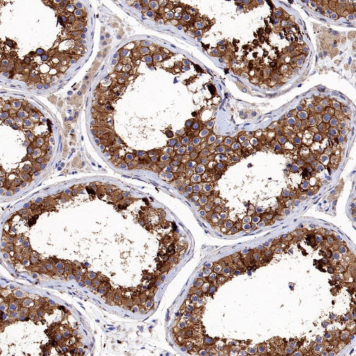 Src Recombinant Rabbit mAb (S-1181-16)