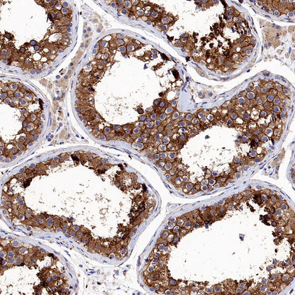 Src Recombinant Rabbit mAb (S-1181-16)