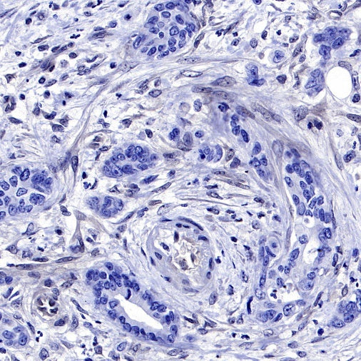 SMAD4 Recombinant Rabbit mAb (SDT-168-62)