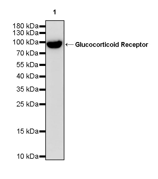Glucocorticoid Receptor Recombinant Rabbit mAb (S-M0030)