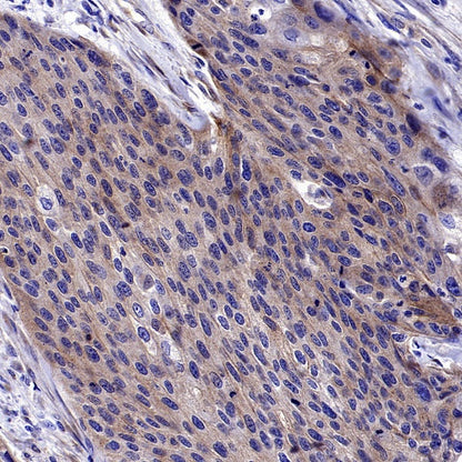 KL Recombinant Rabbit mAb (S-2245-169)