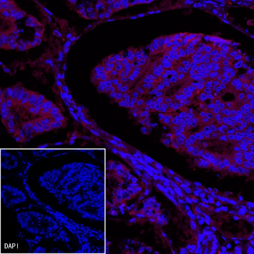 EpCAM Recombinant Rabbit mAb (PE Conjugate) (S-078-13)