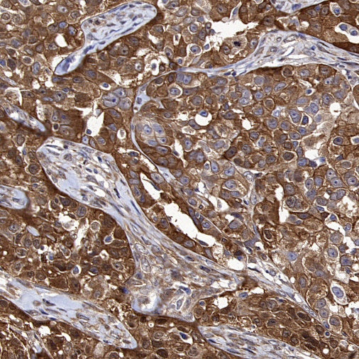LDHB Rabbit Polyclonal Antibody