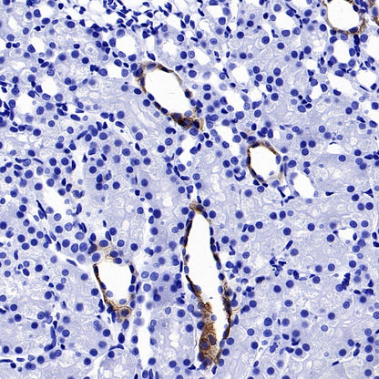 AQP4 Recombinant Rabbit mAb (S-1609-62)