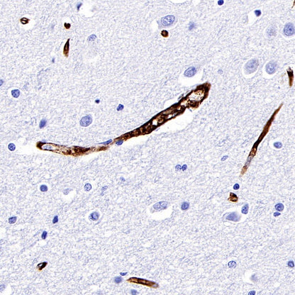 Claudin 5 Recombinant Rabbit mAb (SDT-R322)