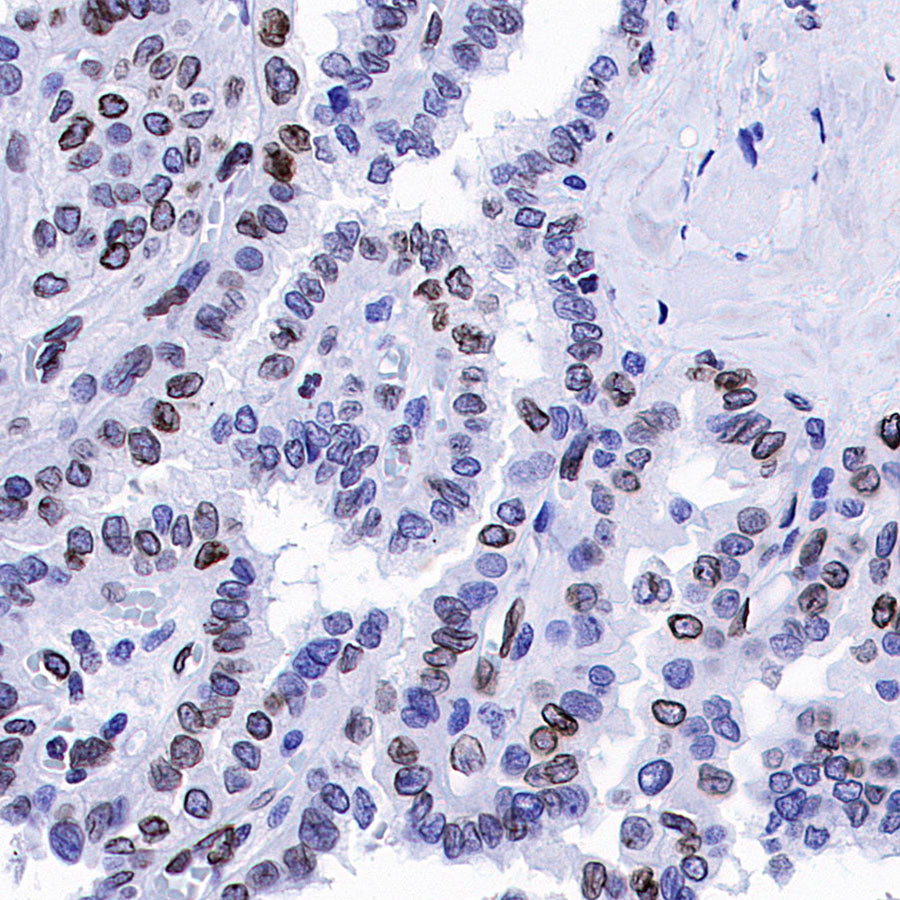 Lamin B1 Recombinant Rabbit mAb (S-5361)