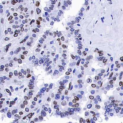 Lamin B1 Recombinant Rabbit mAb (S-5361)