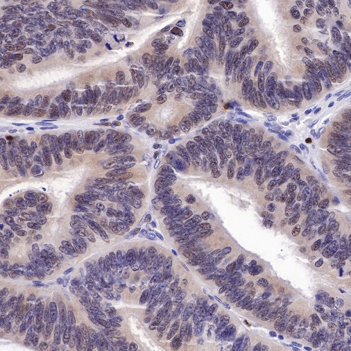 PMS2 Recombinant Rabbit mAb (SDT-111-307)