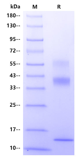 Human TGF-β1 Protein, His Tag