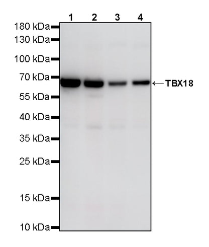 TBX18 Recombinant Rabbit mAb (S-4619-17)