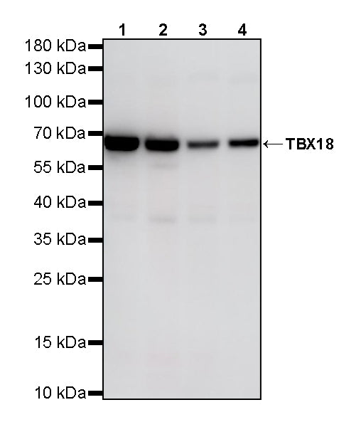 TBX18 Recombinant Rabbit mAb (S-4619-17)