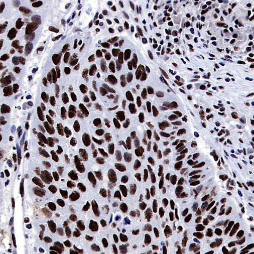 ARID1A Recombinant Rabbit mAb (S-440-62)